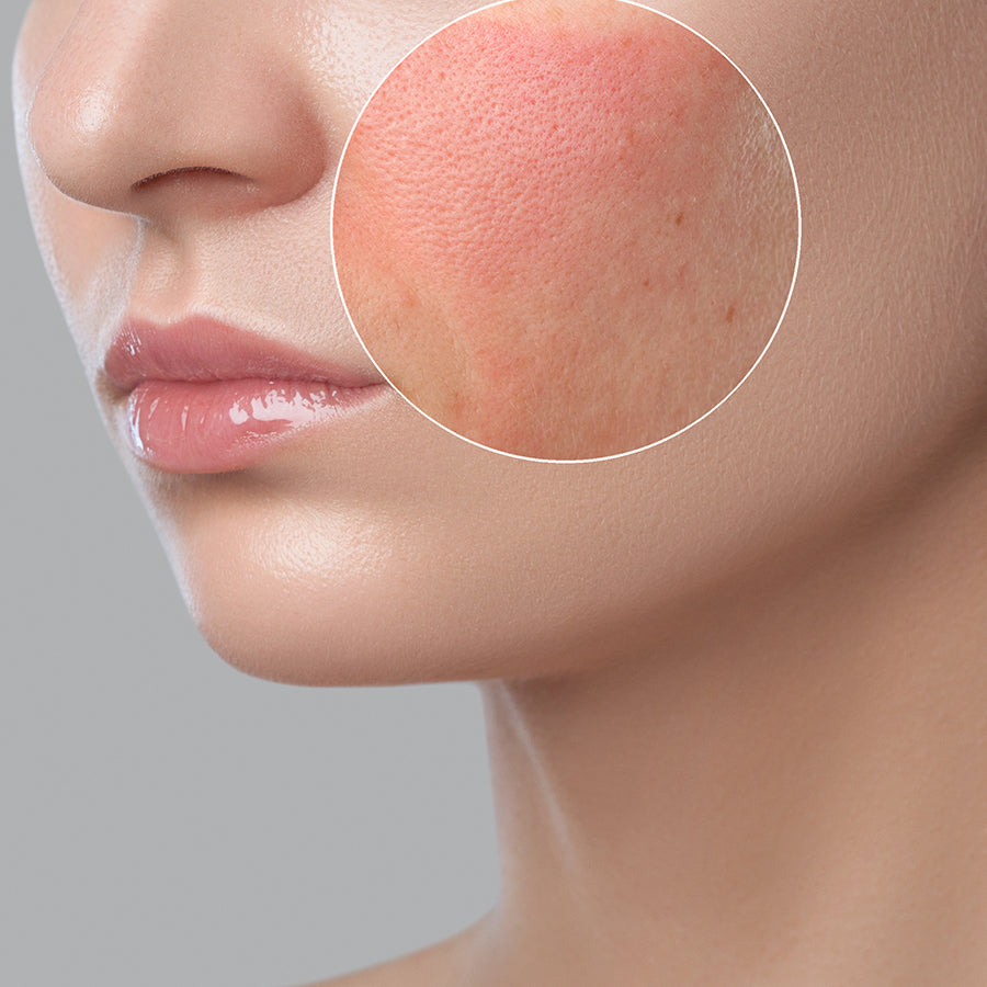 Sensitive Dry Skin Range