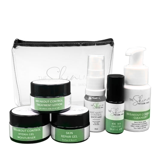 Breakout Control Starter Kit