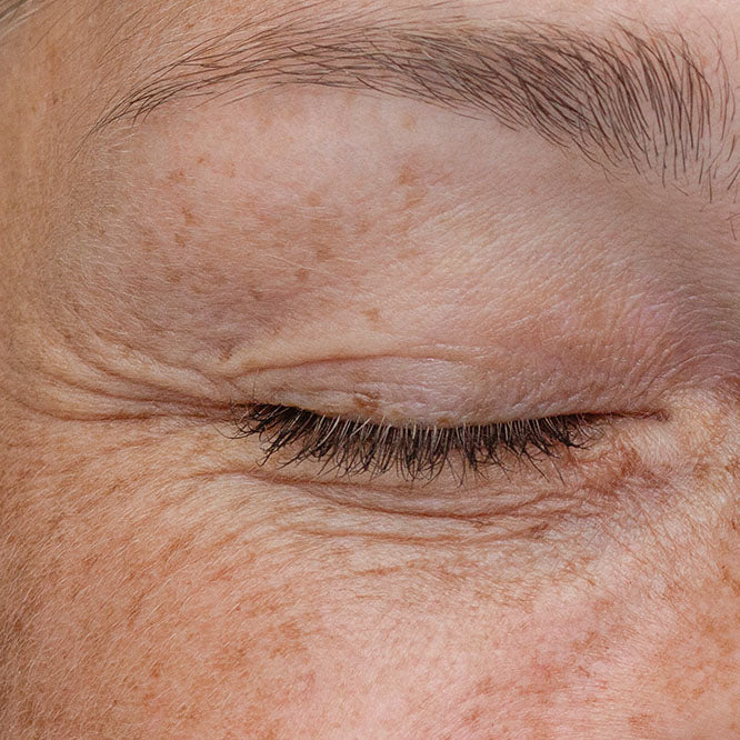 Targeted Skincare for Skin Concerns | The Skin Lab Professionals – The ...