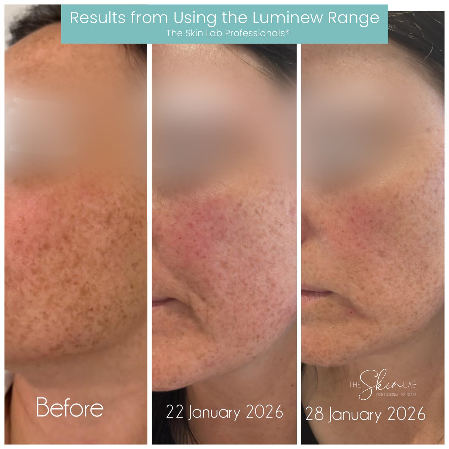 Pro Luminew Renewal Cleanser